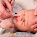 Cách xử lý nghẹt mũi cho trẻ sơ sinh